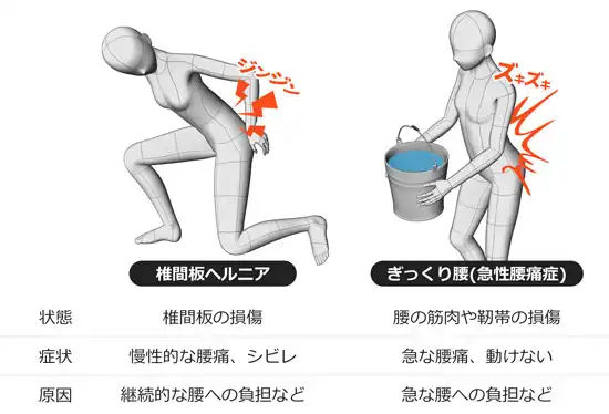 ガードナーベルト、ヘルニア・ぎっくり腰の症状解説図