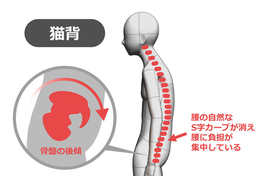 ガードナーベルト猫背イメージ